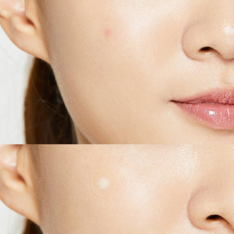 COSRX -  Patchs anti-boutons Pharmacie Lariboisière Shop